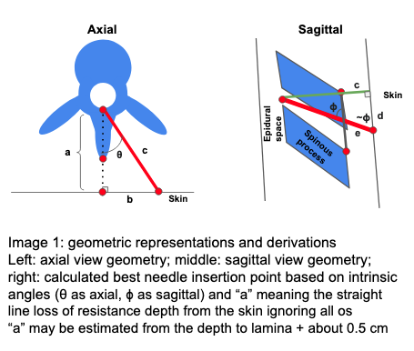 Needle trajectory diagram